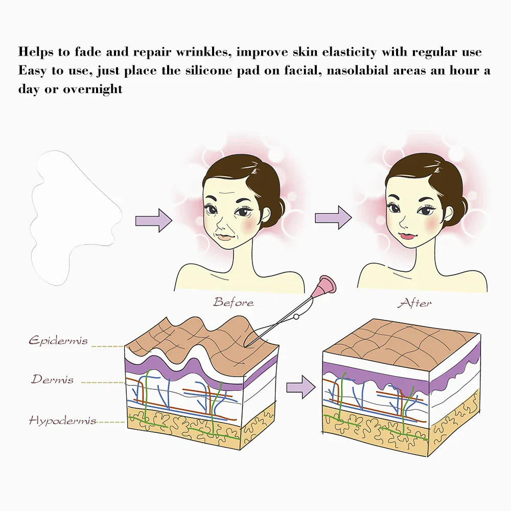 Parches de Silicona Reutilizables para el Contorno Facial | Antiarrugas y Reafirmantes | Para Surcos Nasogenianos | Efecto Lifting y Antienvejecimiento | Cuidado Facial