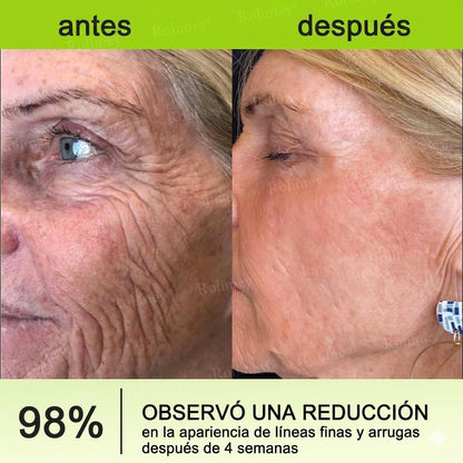 🔥Fabricado y enviado desde España💫Rolimey® Crema Inyectable Reductora de Arrugas y Reafirmante con Botox y Retinol - Último día de promoción, 30% de descuento