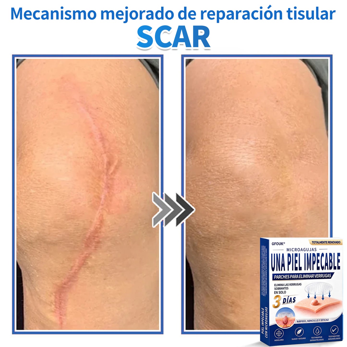 🔥GFOUK® 2026 Parche hidrocoloide de microagujas 2 en 1 versión mejorada | Elimina lunares elevados, acné y verrugas planas | Mejora arrugas, cicatrices e imperfecciones | Parches antiacné invisibles para rostro y cuerpo