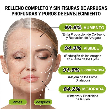 🔥Fabricado y enviado desde España💫Rolimey® Crema Inyectable Reductora de Arrugas y Reafirmante con Botox y Retinol - Último día de promoción, 30% de descuento