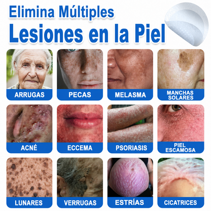 🔥GFOUK® 2026 Parche hidrocoloide de microagujas 2 en 1 versión mejorada | Elimina lunares elevados, acné y verrugas planas | Mejora arrugas, cicatrices e imperfecciones | Parches antiacné invisibles para rostro y cuerpo