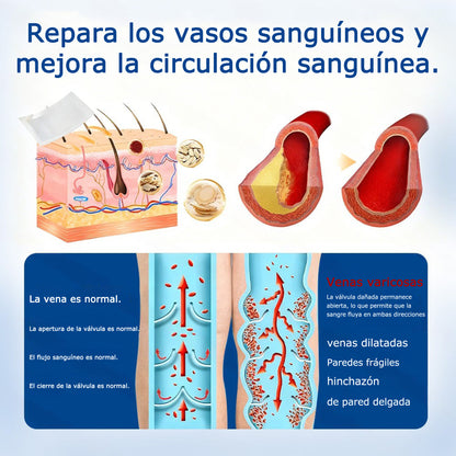 🇪🇸👨‍⚕️✅Parche de microagujas GFOUK® VeinEase para el cuidado de las venas⚡Alivio instantáneo, resultados a largo plazo