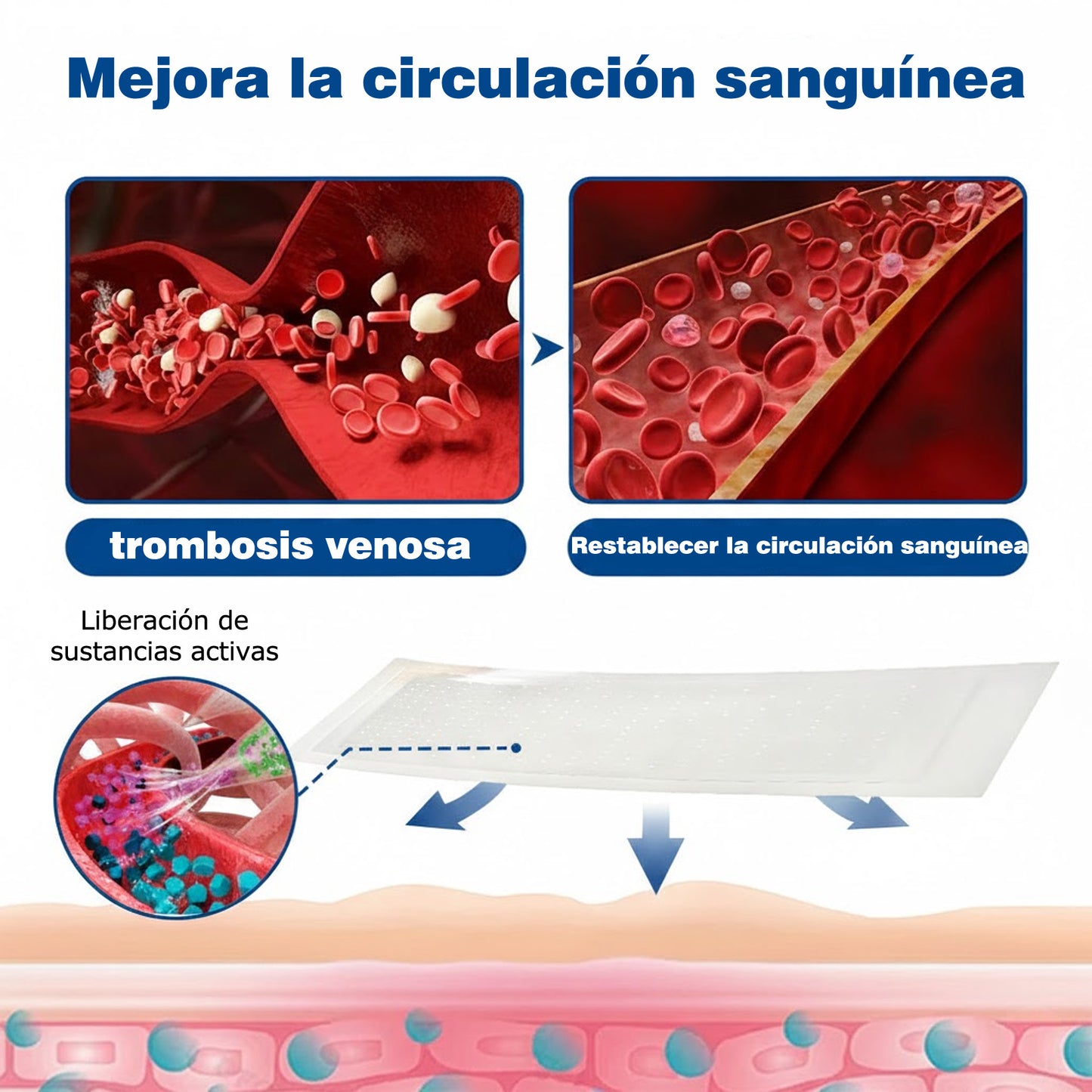 🇪🇸👨‍⚕️✅Parche de microagujas GFOUK® VeinEase para el cuidado de las venas⚡Alivio instantáneo, resultados a largo plazo