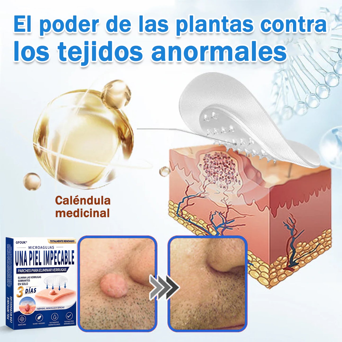 🔥GFOUK® 2026 Parche hidrocoloide de microagujas 2 en 1 versión mejorada | Elimina lunares elevados, acné y verrugas planas | Mejora arrugas, cicatrices e imperfecciones | Parches antiacné invisibles para rostro y cuerpo
