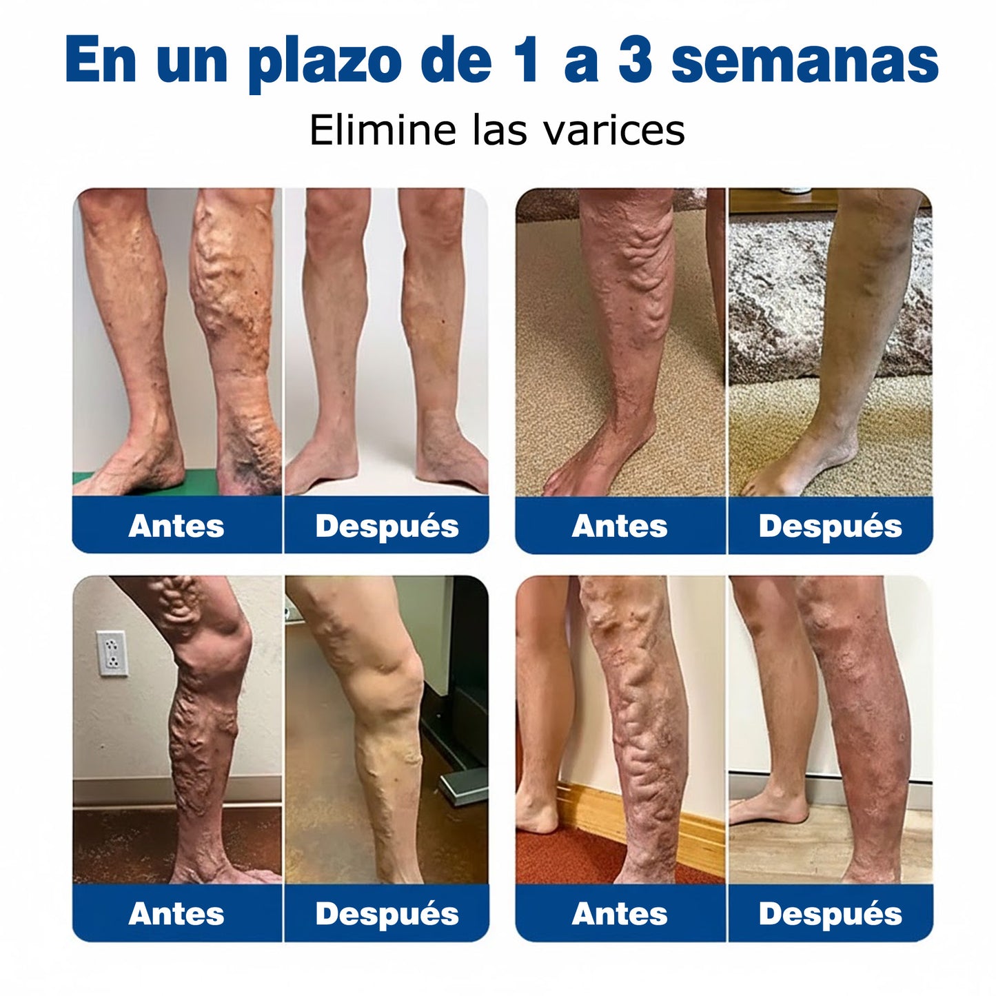 🇪🇸👨‍⚕️✅Parche de microagujas GFOUK® VeinEase para el cuidado de las venas⚡Alivio instantáneo, resultados a largo plazo