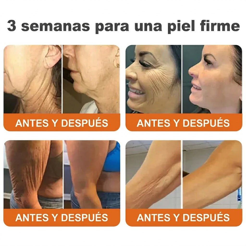 🇪🇸🎁 Hecho y enviado desde España 🎁✨ Crema profesional todo en uno Rolimey® con veneno de abeja 🔥 Último día, 80% de descuento