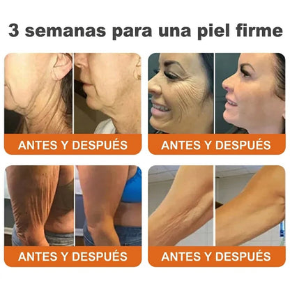 🇪🇸🎁 Hecho y enviado desde España 🎁✨ Crema profesional todo en uno Rolimey® con veneno de abeja 🔥 Último día, 80% de descuento