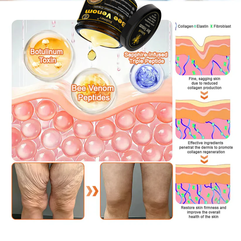 🔥Latest model Rolimey® Bee venom Max Comprehensive Cream - Repair level increased by 65% 🔥 LAST DAY 80% OFF
