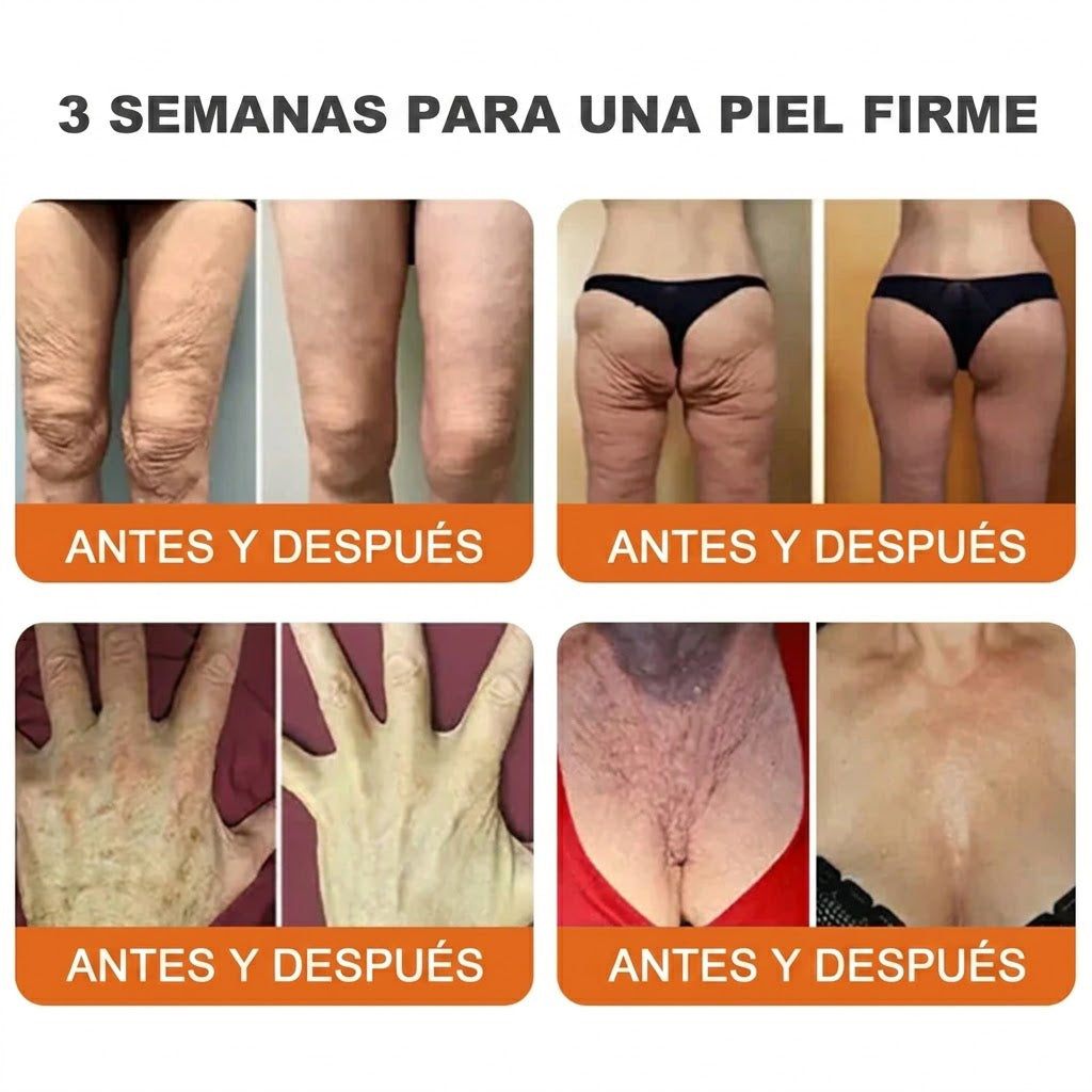 🇪🇸🎁 Hecho y enviado desde España 🎁✨ Crema profesional todo en uno Rolimey® con veneno de abeja 🔥 Último día, 80% de descuento