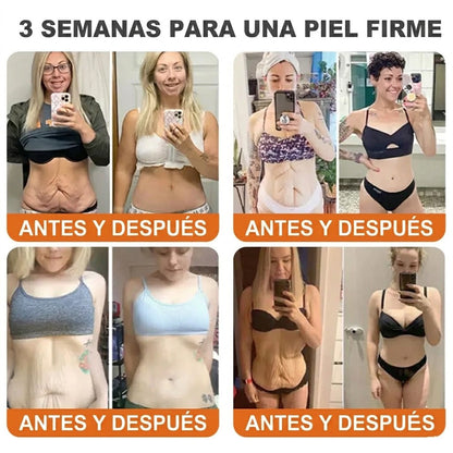 🇪🇸🎁 Hecho y enviado desde España 🎁✨ Crema profesional todo en uno Rolimey® con veneno de abeja 🔥 Último día, 80% de descuento