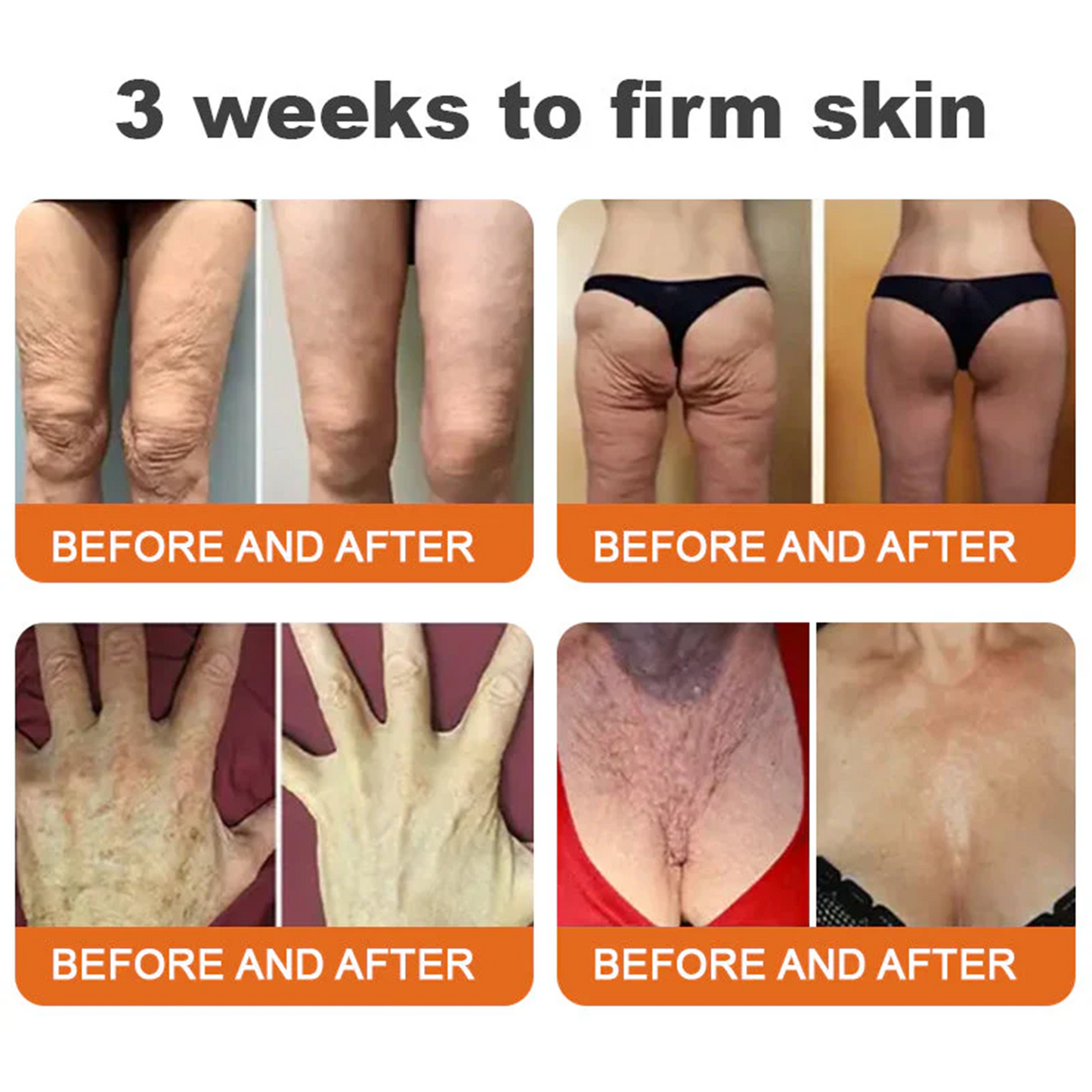 🔥Latest model Rolimey® Bee venom Max Comprehensive Cream - Repair level increased by 65% 🔥 LAST DAY 80% OFF