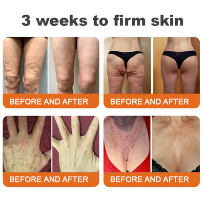 🔥Latest model Rolimey® Bee venom Max Comprehensive Cream - Repair level increased by 65% 🔥 LAST DAY 80% OFF