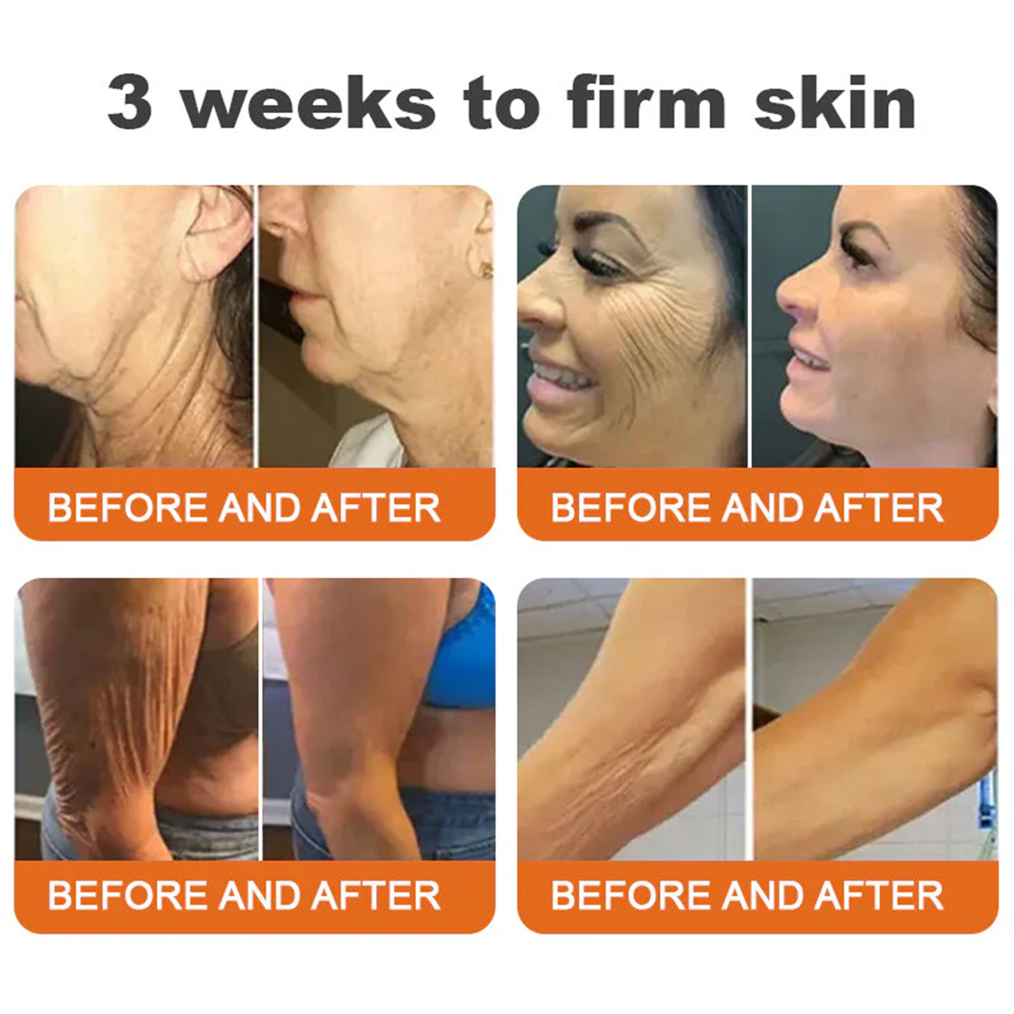 🔥Latest model Rolimey® Bee venom Max Comprehensive Cream - Repair level increased by 65% 🔥 LAST DAY 80% OFF