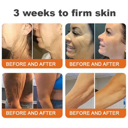 🔥Latest model Rolimey® Bee venom Max Comprehensive Cream - Repair level increased by 65% 🔥 LAST DAY 80% OFF