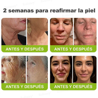 🔥Fabricado y enviado desde España💫Rolimey® Crema Inyectable Reductora de Arrugas y Reafirmante con Botox y Retinol - Último día de promoción, 30% de descuento