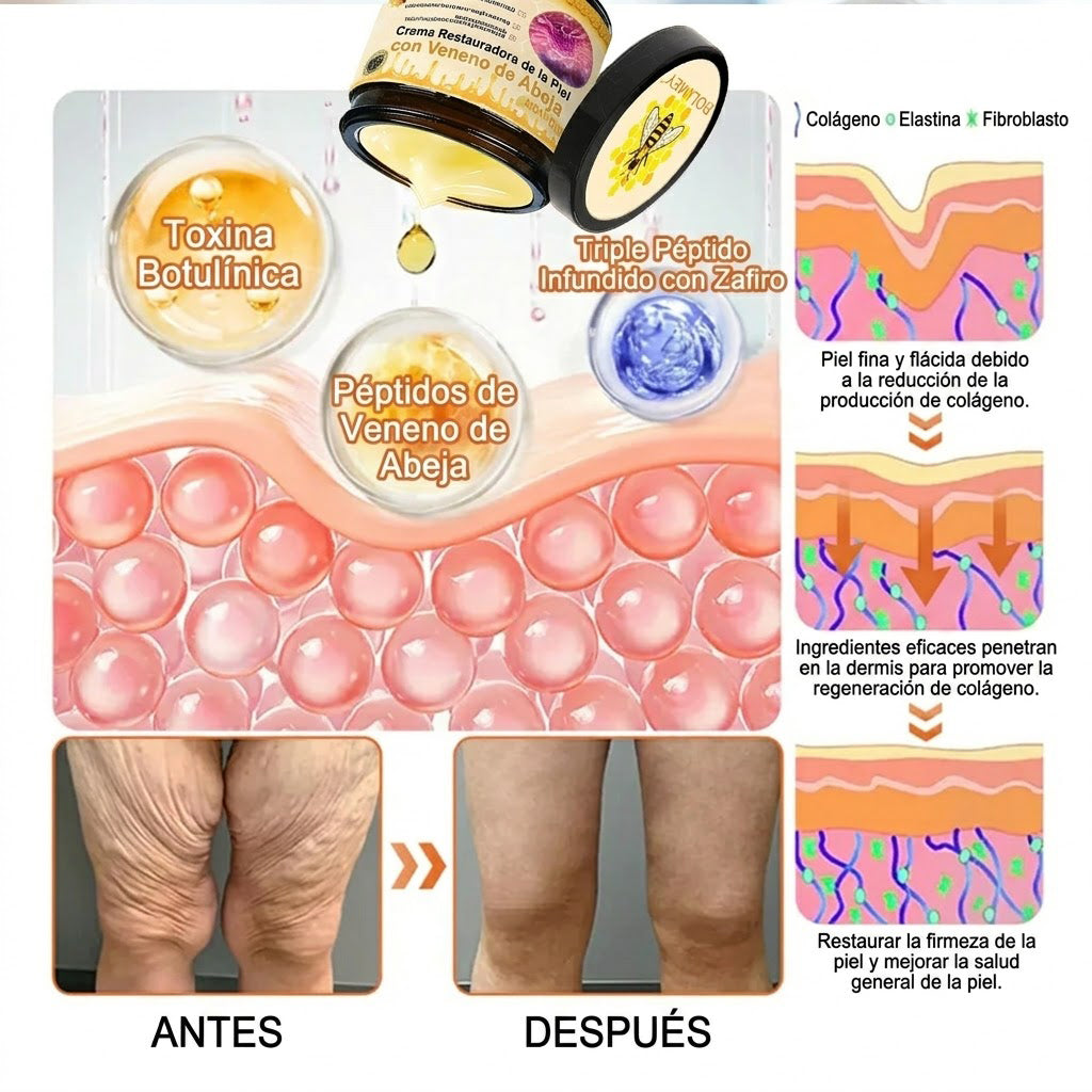 🇪🇸🎁 Hecho y enviado desde España 🎁✨ Crema profesional todo en uno Rolimey® con veneno de abeja 🔥 Último día, 80% de descuento