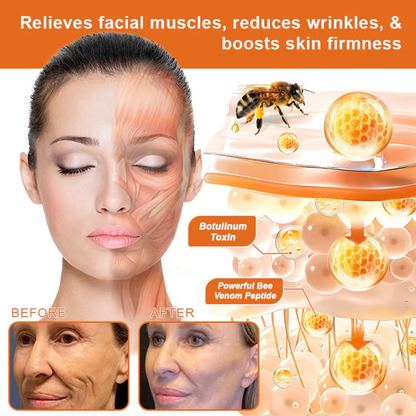 🔥Latest model Rolimey® Bee venom Max Comprehensive Cream - Repair level increased by 65% 🔥 LAST DAY 80% OFF