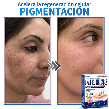 🔥GFOUK® 2026 Parche hidrocoloide de microagujas 2 en 1 versión mejorada | Elimina lunares elevados, acné y verrugas planas | Mejora arrugas, cicatrices e imperfecciones | Parches antiacné invisibles para rostro y cuerpo