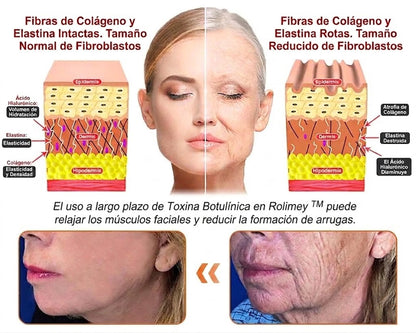 🇪🇸🎁 Hecho y enviado desde España 🎁✨ Crema profesional todo en uno Rolimey® con veneno de abeja 🔥 Último día, 80% de descuento