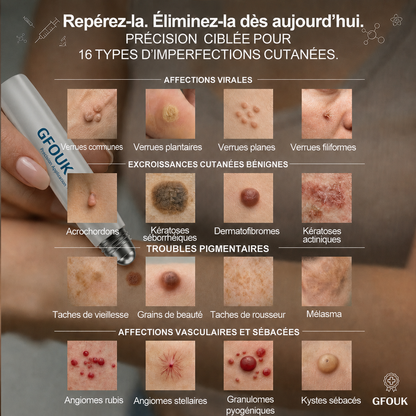 🧑‍⚕️Tienda oficial de la marca | 🖊️GFOUK® Eliminador de manchas y verrugas en 7 días (Cero dolor, cero cicatrices – Roller) 🪴